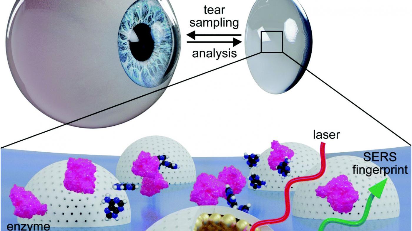 Investigadores do Cinbio deseñan unhas lentes de contacto que permiten a análise de biomarcadores lacrimais para a detección de enfermidades